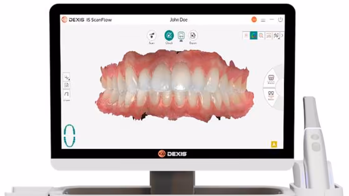 Dexis intraoral photo