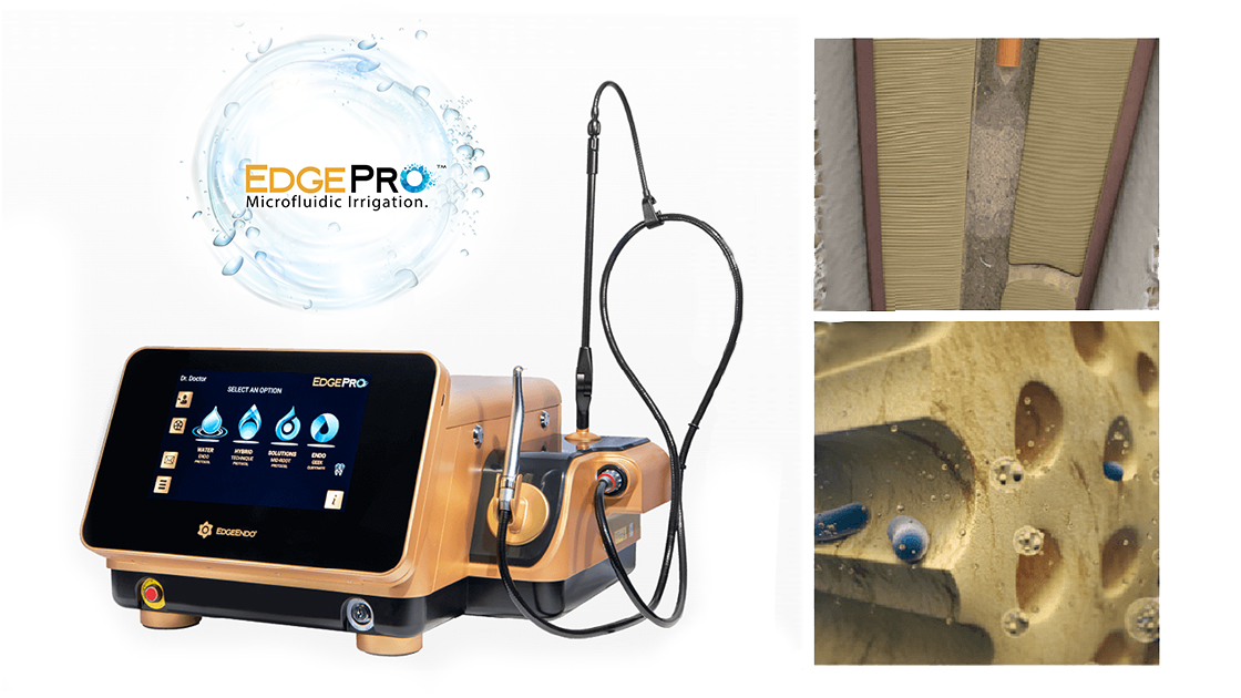 Edgepro endo photo