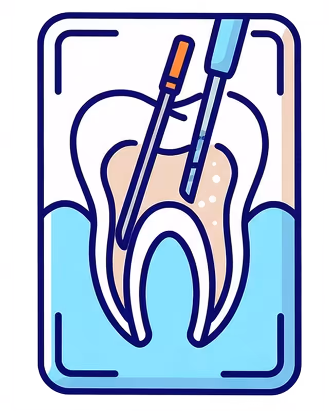 Root canal photo